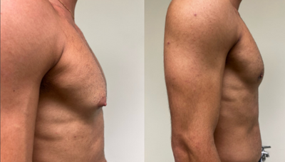 BEFORE AND AFTER