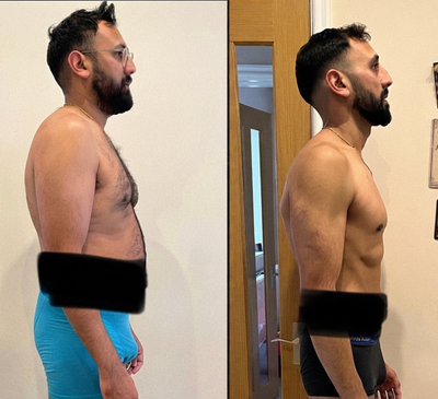 BEFORE AND AFTER
