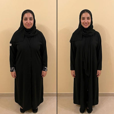 BEFORE AND AFTER