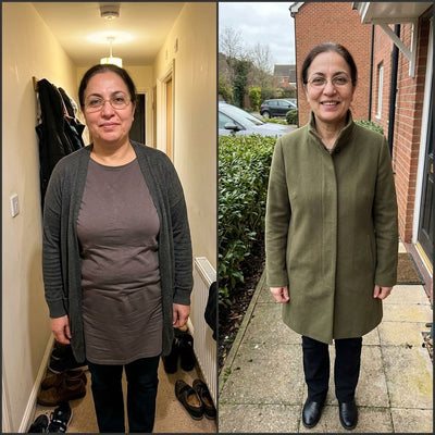 BEFORE AND AFTER