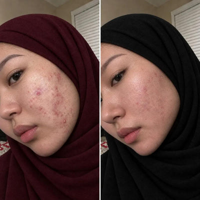 BEFORE AND AFTER
