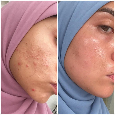 BEFORE AND AFTER